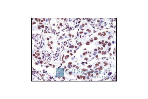 Immunohistochemistry Image 1: Acetyl-Histone H3 (Lys18) Antibody