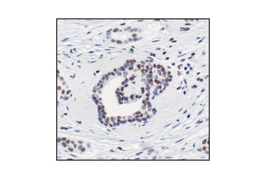 Immunohistochemistry Image 1: Acetyl-Histone H3 (Lys9/Lys14) Antibody
