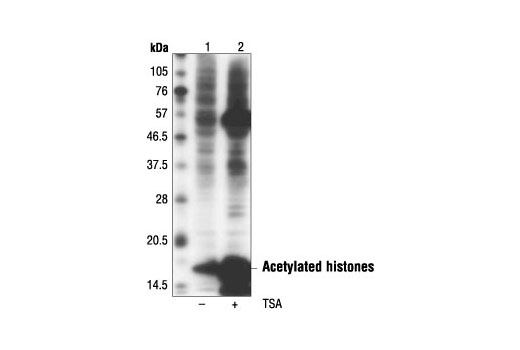 Western Blotting Image 1: Acetylated-Lysine (Ac-K-103) Mouse mAb