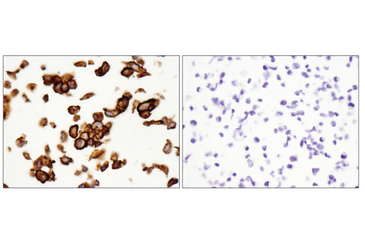 Immunohistochemistry Image 4: CD44 (E7K2Y) XP® Rabbit mAb (BSA and Azide Free)