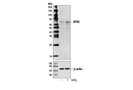 Western Blotting Image 1: NT5E/CD73 Antibody