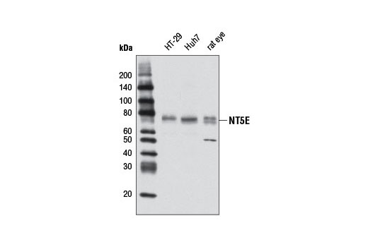 Western Blotting Image 2: NT5E/CD73 Antibody