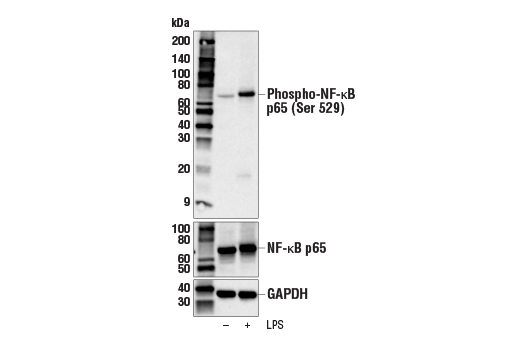 Western Blotting Image 1: Phospho-NF-κB p65 (Ser529) Antibody