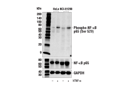  Image 13: NF-κB Pathway Antibody Sampler Kit II