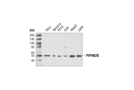 Western Blotting Image 1: PIP4K2B Antibody