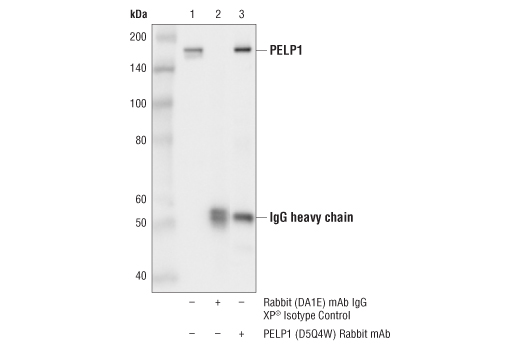 Immunoprecipitation Image 1: PELP1 (D5Q4W) Rabbit mAb
