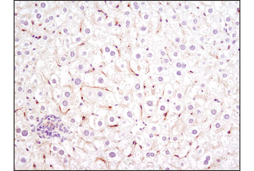  Image 24: Angiogenesis Receptor Tyrosine Kinase Antibody Sampler Kit