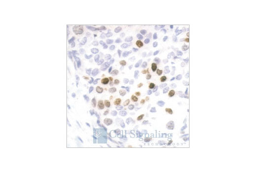 Immunohistochemistry Image 1: Phospho-Histone H3 (Ser10) Antibody