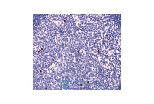 Immunohistochemistry Image 4: Phospho-Histone H3 (Ser10) Antibody