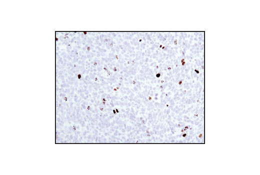 Immunohistochemistry Image 5: Phospho-Histone H3 (Ser10) Antibody