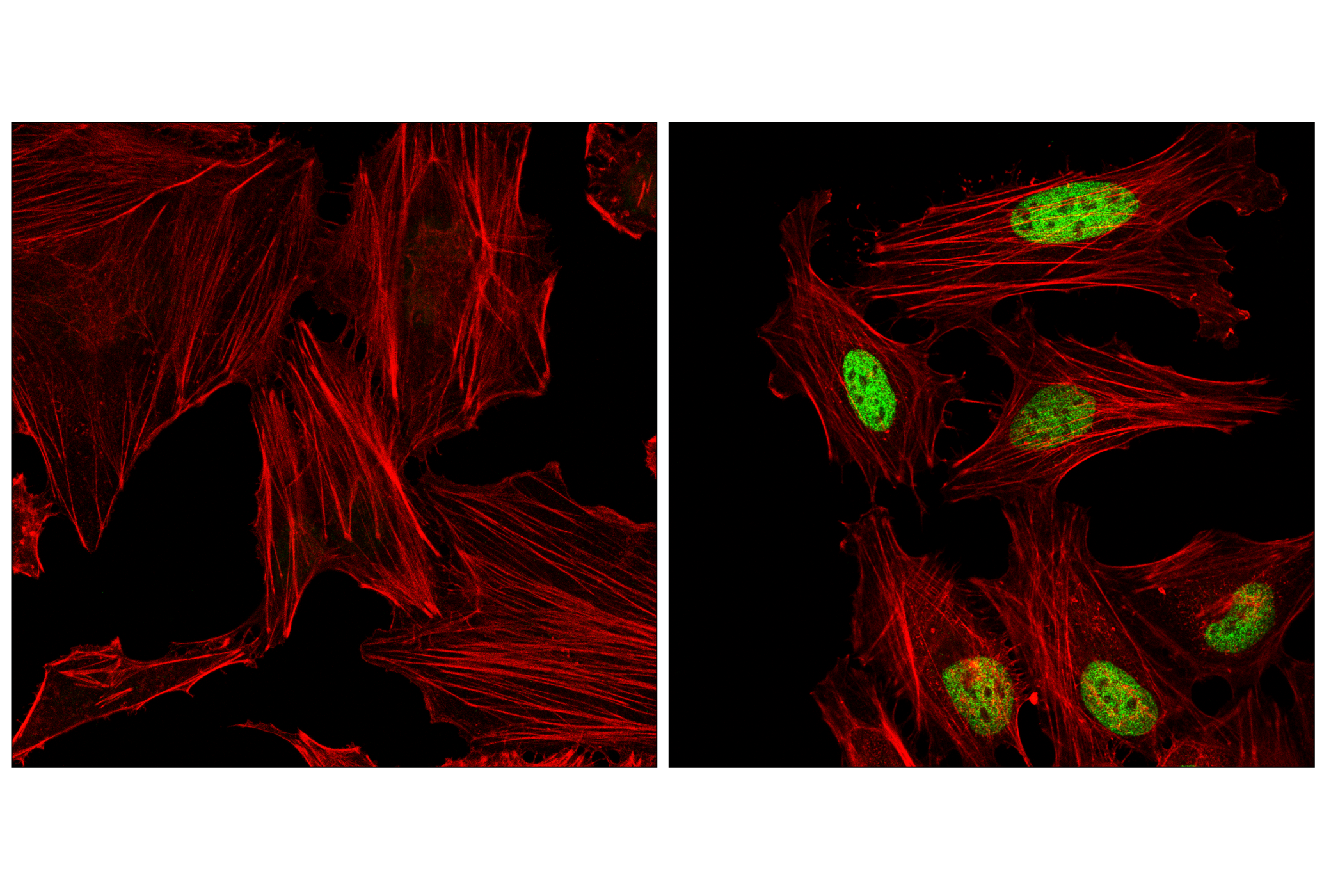 Immunofluorescence Image 1: ATF-4 (E4Q4E) Mouse mAb