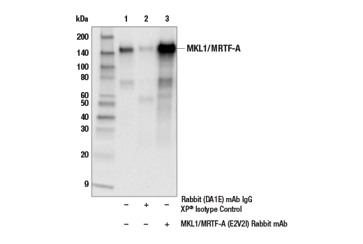 Immunoprecipitation Image 1: MKL1/MRTF-A (E2V2I) Rabbit mAb