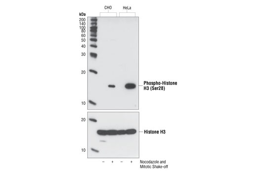  Image 4: Phospho-Histone H3 (Mitotic Marker) Antibody Sampler Kit