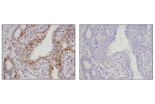 Immunohistochemistry Image 4: Phospho-Histone H2A.X (Ser139) (D7T2V) Mouse mAb (BSA and Azide Free)