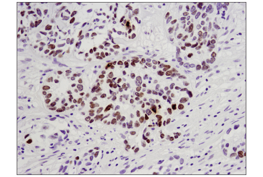 Immunohistochemistry Image 5: Phospho-Histone H2A.X (Ser139) (D7T2V) Mouse mAb (BSA and Azide Free)