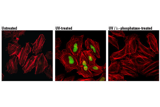 Immunofluorescence Image 1: Phospho-Histone H2A.X (Ser139) (D7T2V) Mouse mAb (BSA and Azide Free)