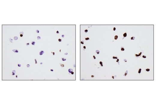 Immunohistochemistry Image 7: Phospho-Histone H2A.X (Ser139) (D7T2V) Mouse mAb (BSA and Azide Free)