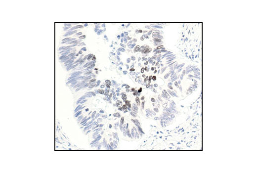 Immunohistochemistry Image 1: Phospho-Histone H3 (Thr3) Antibody