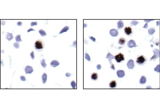 Immunohistochemistry Image 2: Phospho-Histone H3 (Thr3) Antibody
