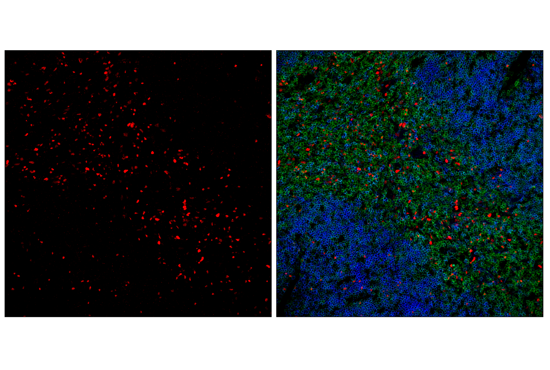 Immunofluorescence Image 1: T-bet/TBX21 (E4I2K) Rabbit mAb (Alexa Fluor® 555 Conjugate)