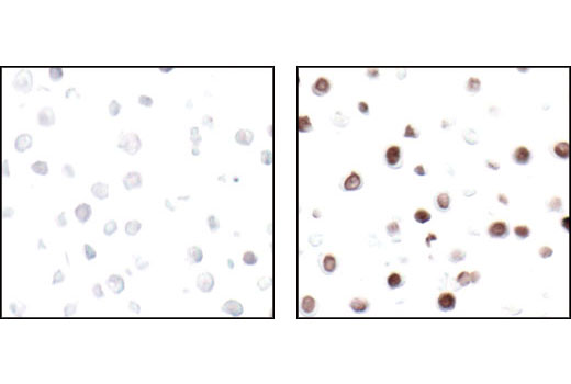  Image 41: Mouse Reactive Senescence Marker Antibody Sampler Kit