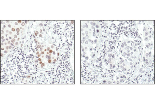 Immunohistochemistry Image 2: Phospho-Histone H2A.X (Ser139) (20E3) Rabbit mAb