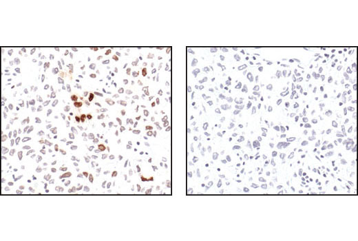  Image 37: Mouse Reactive Senescence Marker Antibody Sampler Kit