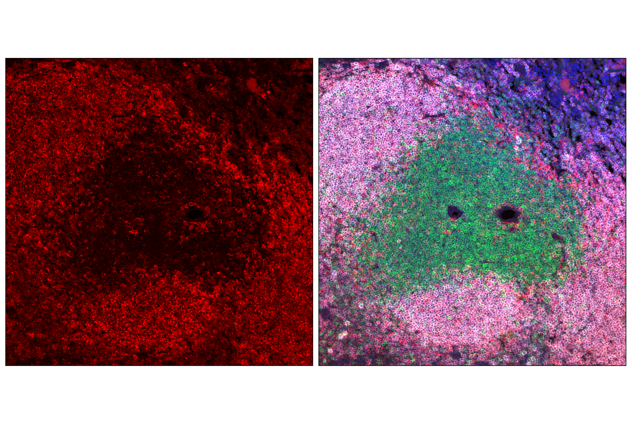 Immunofluorescence Image 1: PLCγ2 (F9L8Z) Rabbit mAb
