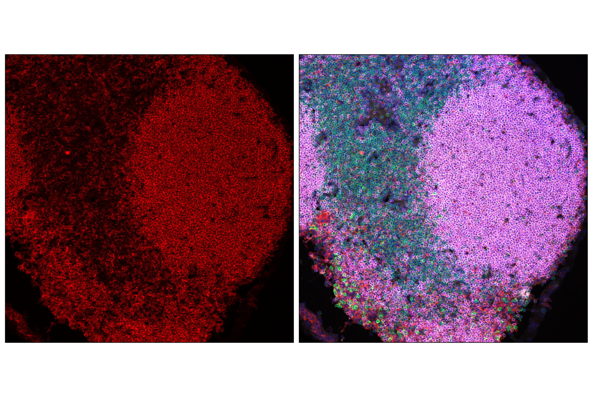 Immunofluorescence Image 2: PLCγ2 (F9L8Z) Rabbit mAb