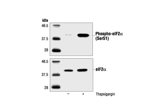 Western Blotting Image 1: Phospho-eIF2α (Ser51) Antibody