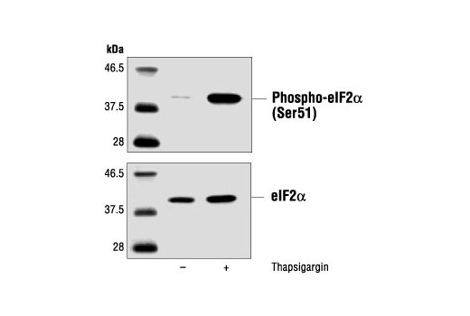 Western Blotting Image 1: eIF2α Antibody