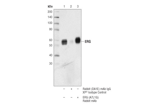 Immunoprecipitation Image 1: ERG (A7L1G) Rabbit mAb