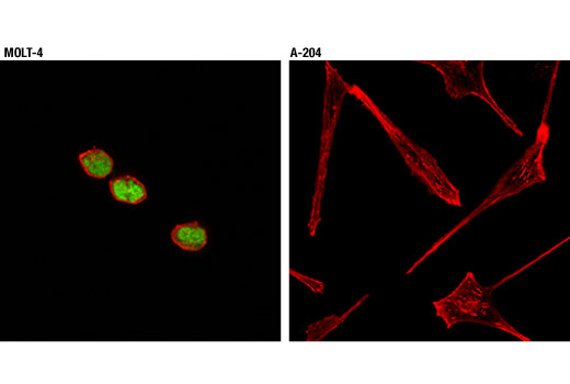 Immunofluorescence Image 1: ERG (A7L1G) Rabbit mAb