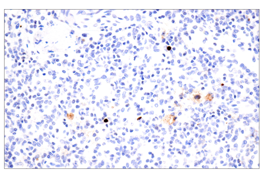 Immunohistochemistry Image 4: Citrullinated Histone H3 (Arg17) (E4O3F) Rabbit mAb