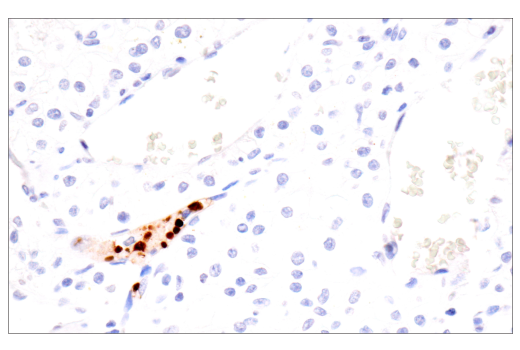 Immunohistochemistry Image 3: Citrullinated Histone H3 (Arg17) (E4O3F) Rabbit mAb