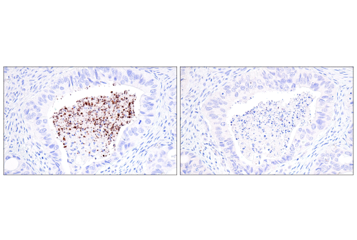 Immunohistochemistry Image 8: Citrullinated Histone H3 (Arg17) (E4O3F) Rabbit mAb