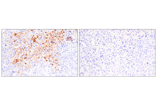 Immunohistochemistry Image 9: Citrullinated Histone H3 (Arg17) (E4O3F) Rabbit mAb