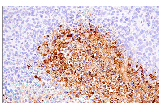 Immunohistochemistry Image 6: Citrullinated Histone H3 (Arg17) (E4O3F) Rabbit mAb