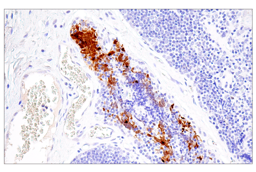 Immunohistochemistry Image 5: Citrullinated Histone H3 (Arg17) (E4O3F) Rabbit mAb