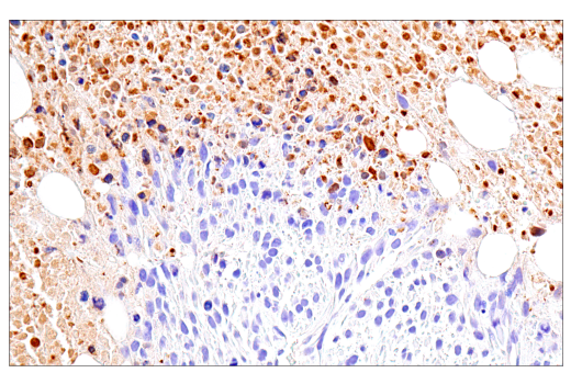 Immunohistochemistry Image 7: Citrullinated Histone H3 (Arg17) (E4O3F) Rabbit mAb