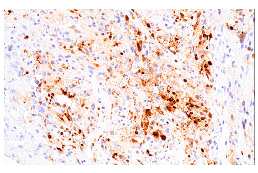 Immunohistochemistry Image 1: Citrullinated Histone H3 (Arg17) (E4O3F) Rabbit mAb