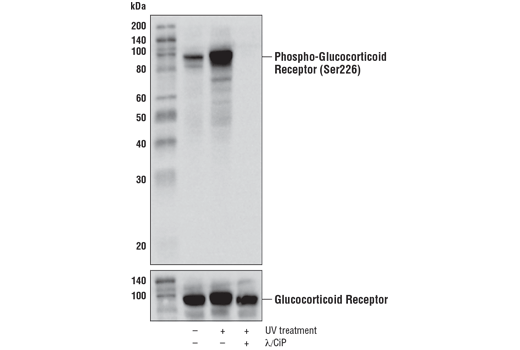 Western Blotting Image 1: Phospho-Glucocorticoid Receptor (Ser226) (D9D3V) Rabbit mAb