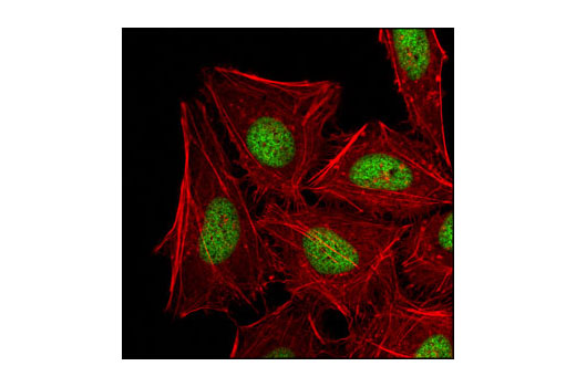 Immunofluorescence Image 1: Di-Methyl-Histone H3 (Lys27) (D18C8) XP® Rabbit mAb