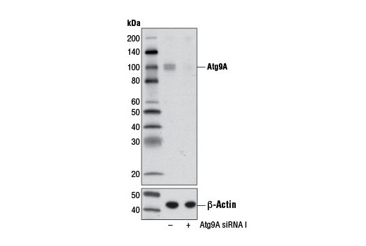Western Blotting Image 1: Atg9A Antibody