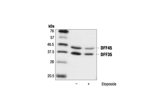 Western Blotting Image 1: DFF45/DFF35 Antibody