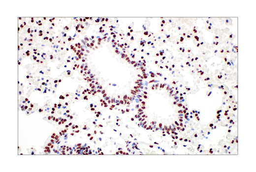  Image 18: Polycomb Group Antibody Sampler Kit