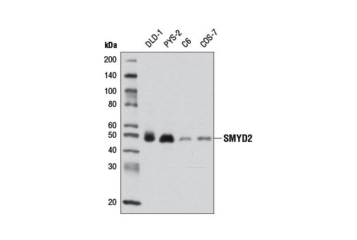  Image 9: Lysine Methyltransferase Antibody Sampler Kit