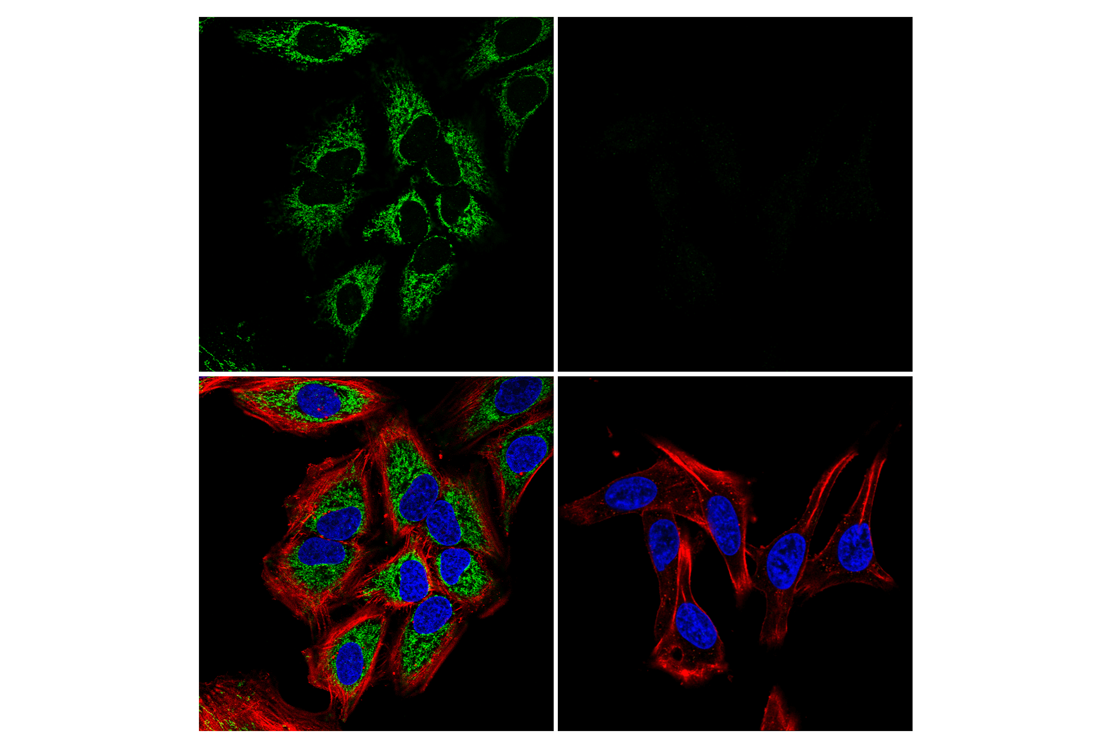 Immunofluorescence Image 1: CPT1A (E3Y1V) Rabbit mAb