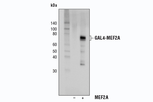 Western Blotting Image 1: MEF2A Antibody