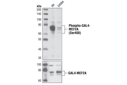 Western Blotting Image 1: Phospho-MEF2A (Ser408) Antibody